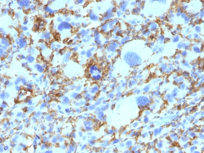 Monoclonal Antibody to HLA-DRB (MHC II)(Clone : SPM423)