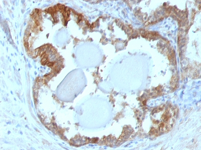 Monoclonal Antibody to HSP27 (Heat Shock Protein 27)(Clone : G3.1)