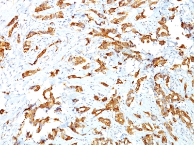 Monoclonal Antibody to HSP27 (Heat Shock Protein 27)(Clone : SPM252)