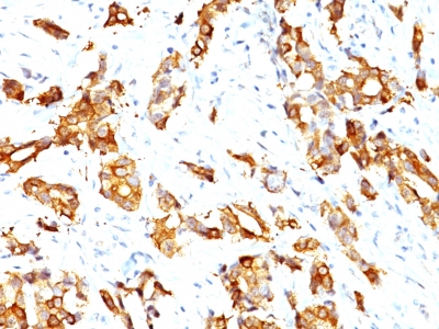 Monoclonal Antibody to HSP27 (Heat Shock Protein 27)(Clone : HSPB1/774)