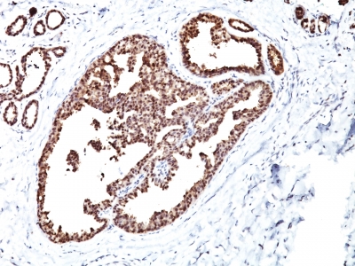 Monoclonal Antibody to HSP60 (Heat Shock Protein 60) (Mitochondrial Marker)(Clone : LK1)