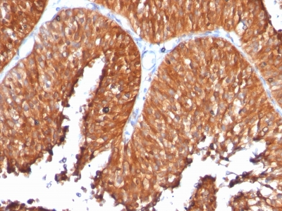 Monoclonal Antibody to HSP60 (Heat Shock Protein 60) (Mitochondrial Marker)(Clone : SPM253)