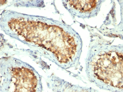 Monoclonal Antibody to HSP60 (Heat Shock Protein 60) (Mitochondrial Marker)(Clone : GROEL/730)