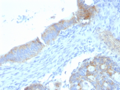 Monoclonal Antibody to Heparan Sulfate Proteoglycan (Large) / Perlecan(Clone : SPM255)