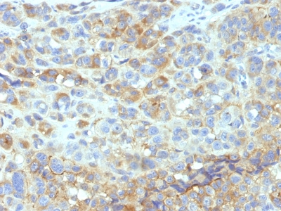 Monoclonal Antibody to CD54 / ICAM-1(Clone : W-CAM-1; same as Wehi-CAM-1 or 1H4)