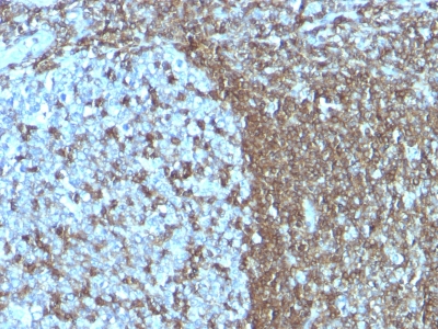 Monoclonal Antibody to CD50 / ICAM-3(Clone : SPM505)