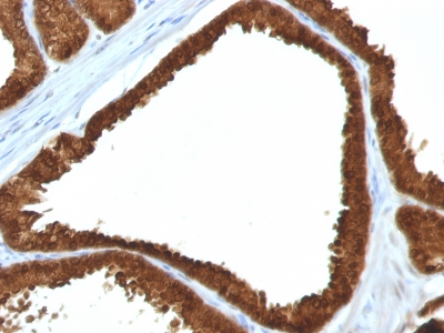 Monoclonal Antibody to IDH1 (Isocitrate Dehydrogenase)(Clone : IDH1/1152)