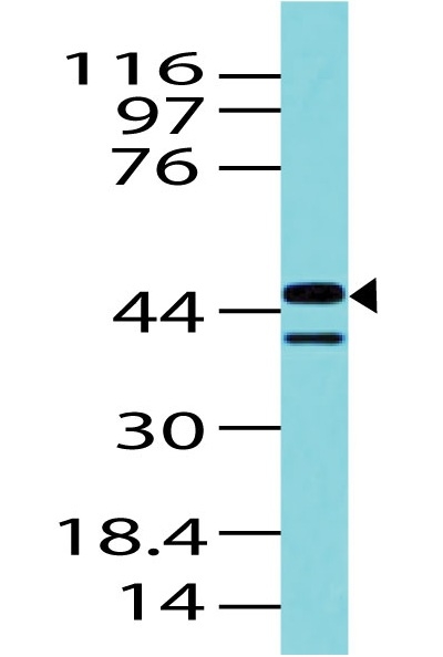 Polyclonal Antibody to IDH1 (Isocitrate Dehydrogenase)(Discontinued)