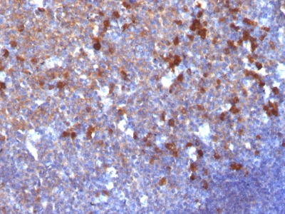 Monoclonal Antibody to IgG (Immunoglobulin Gamma Heavy Chain) (B-Cell Marker)(Clone : IG217)