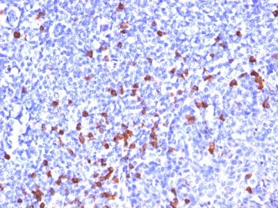 Monoclonal Antibody to IgG (Immunoglobulin Gamma Heavy Chain) (B Cell Marker)(Clone : SPM556)