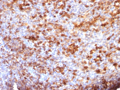 Monoclonal Antibody to IgG (Immunoglobulin Gamma Heavy Chain) (B-Cell Marker)(Clone : B33/20)