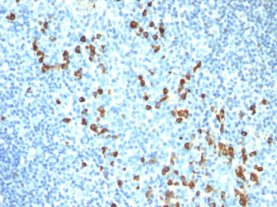 Monoclonal Antibody to IgM (Immunoglobulin Mu Heavy Chain) (B-Cell Marker)(Clone : ICO-30)