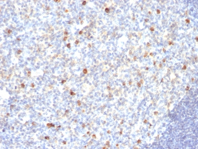 Monoclonal Antibody to IgM (Immunoglobulin Mu Heavy Chain) (B-Cell Marker)(Clone : SPM188)