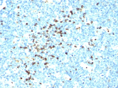 Monoclonal Antibody to IgM (Immunoglobulin Mu Heavy Chain) (B-Cell Marker)(Clone : DA4-4; same as SA-DA4 or H