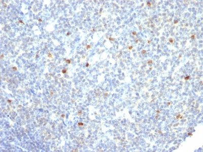 Monoclonal Antibody to IgM (Immunoglobulin Mu Heavy Chain) (B-Cell Marker)(Clone : IM260)