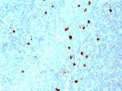 Monoclonal Antibody to IgM (Immunoglobulin Mu Heavy Chain) (B-Cell Marker)(Clone : SPM557)