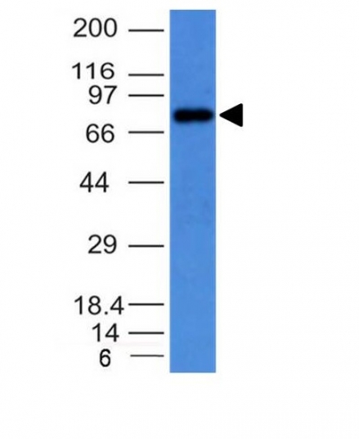 Monoclonal Antibody to IgM (Immunoglobulin Mu Heavy Chain) (B-Cell Marker)(Clone : IM373)