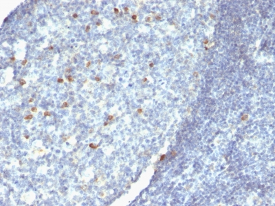 Monoclonal Antibody to IgM (Immunoglobulin Mu Heavy Chain) (B-Cell Marker)(IM260 + IM373 + ICO-30)