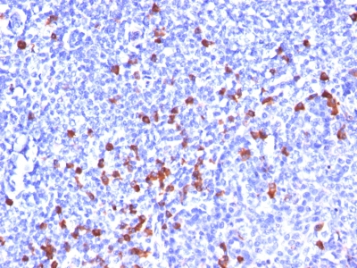 Monoclonal Antibody to Kappa Light Chain (B-Cell Marker)(Clone : SPM508)