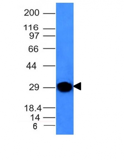 Monoclonal Antibody to Kappa Light Chain (B-Cell Marker)(Clone : KLC264)