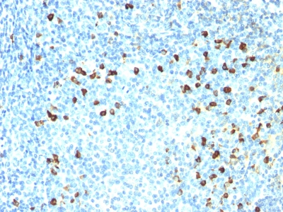 Monoclonal Antibody to Kappa Light Chain (B-Cell Marker)(Clone : SPM558)