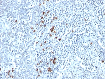 Monoclonal Antibody to Kappa Light Chain (B-Cell Marker)(Clone : TB28-2)