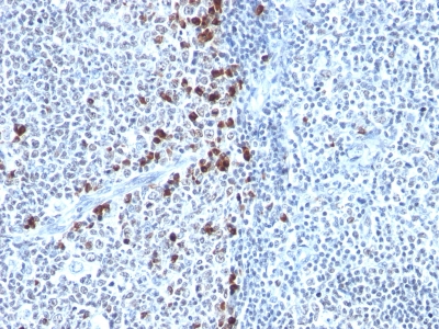 Monoclonal Antibody to Kappa Light Chain (B-Cell Marker)(Clone : HP6053)