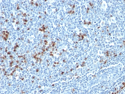 Monoclonal Antibody to Kappa Light Chain (B-Cell Marker)(HP6053 + L1C1)