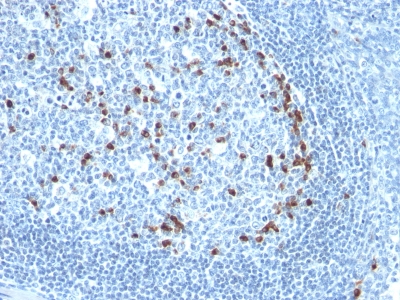 Monoclonal Antibody to Kappa Light Chain (B-Cell Marker)(Clone : KLC709)