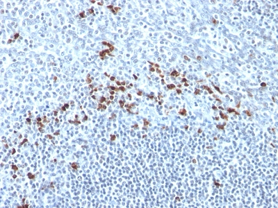 Monoclonal Antibody to Kappa Light Chain (B-Cell Marker)(Clone : Kap-56)