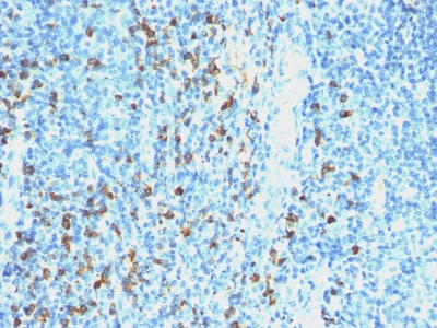 Monoclonal Antibody to Lambda Light Chain (B-Cell Marker)(Clone : SPM559)