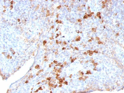 Monoclonal Antibody to Lambda Light Chain (B-Cell Marker)(Clone : LAM03)