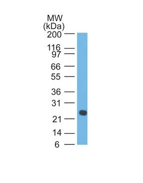 Monoclonal Antibody to Lambda Light Chain (B-Cell Marker)(LcN-2 + ICO-106)