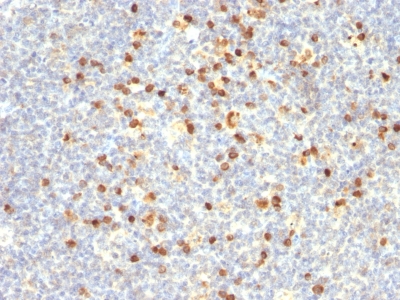 Monoclonal Antibody to Lambda Light Chain (B-Cell Marker)(Clone : Lamb14)(Discontinued)