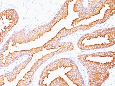 Monoclonal Antibody to Prostate Specific Antigen (PSA)(Clone : SPM352)