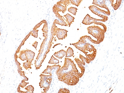 Monoclonal Antibody to Prostate Specific Antigen (PSA)(Clone : KLK3/801)