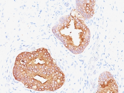 Monoclonal Antibody to Prostate Specific Antigen (PSA)(Clone : 1A7; same as 1A7G6B6)