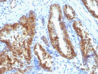 Monoclonal Antibody to Prostate Specific Antigen (PSA)(A67-B/E3 + 1A7)