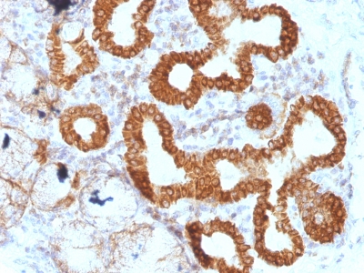 Monoclonal Antibody to IL-6 (Interleukin-6) / Interferon beta-2 (Hybridoma Growth Factor)(Clone : IL6/1270)(Discontinued)