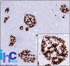 Monoclonal Antibody to Insulin / IRDN (beta-Cell & Insulinoma Marker)(Clone : SPM531)