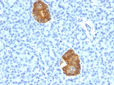 Monoclonal Antibody to Insulin / IRDN (beta-Cell & Insulinoma Marker)(E2-E3 + 2D11-H5; same as INS04 + INS05)