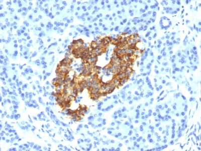 Monoclonal Antibody to Insulin / IRDN (beta-Cell & Insulinoma Marker)(Clone : IRDN/794)