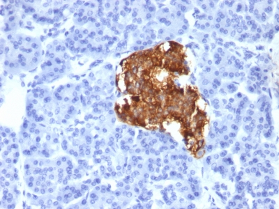 Monoclonal Antibody to Insulin / IRDN (beta-Cell & Insulinoma Marker)(Clone : IRDN/805)