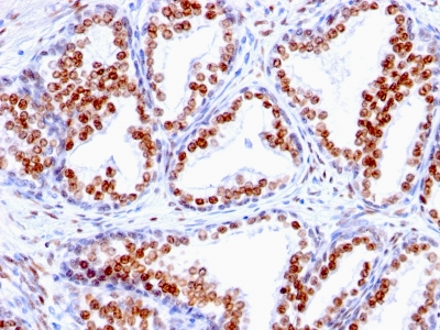 Monoclonal Antibody to Androgen Receptor (Marker of Androgen Dependence)(Clone : SPM335)