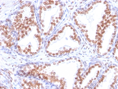 Monoclonal Antibody to Androgen Receptor (Marker of Androgen Dependence)(Clone : DHTR/882)