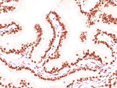 Monoclonal Antibody to Androgen Receptor (Marker of Androgen Dependence)(AR441 + DHTR/882)