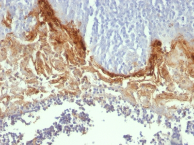 Monoclonal Antibody to Involucrin (Squamous Cell Terminal Differentiation Marker)(Clone : SY5)