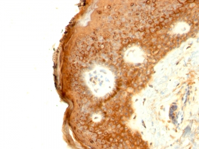 Monoclonal Antibody to Involucrin (Squamous Cell Terminal Differentiation Marker)(Clone : SPM259)