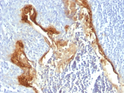 Monoclonal Antibody to Involucrin (Squamous Cell Terminal Differentiation Marker)(Clone : IVRN/827)