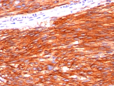 Monoclonal Antibody to CD117 / c-Kit (Marker for Gastrointestinal Stromal Tumors)(Clone : C117/370)